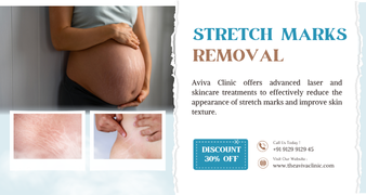 Stretch Mark & Scar Treatments